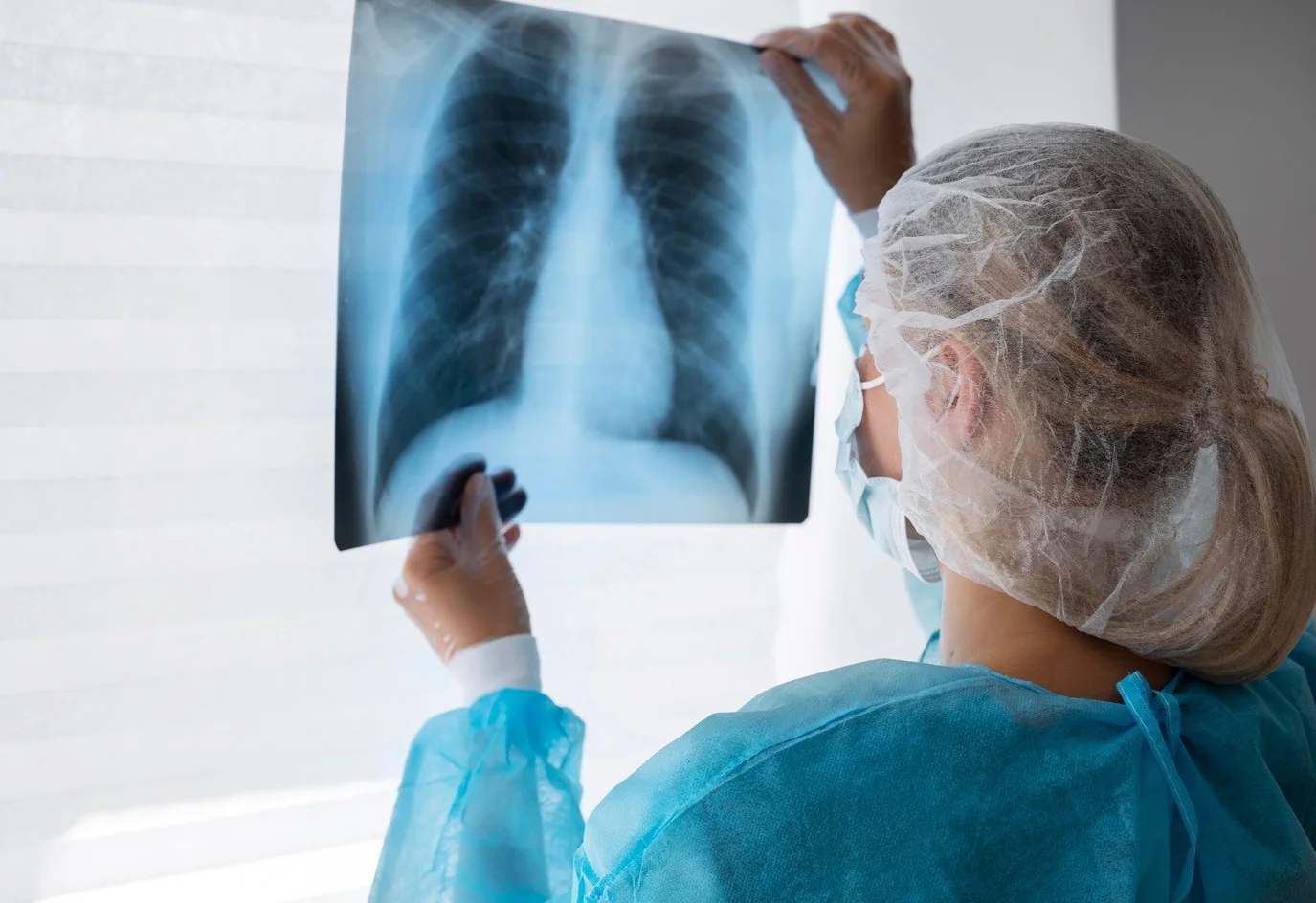 Doença Pulmonar Obstrutiva Crônica