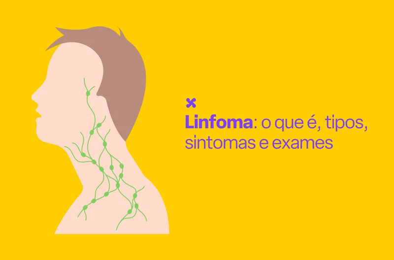 Linfoma: o que é, tipos, sintomas e exames