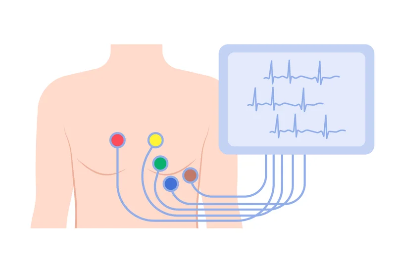 HOLTER 24 HORAS: para que serve, como funciona, resultados