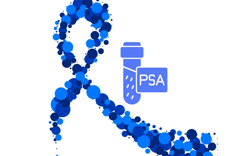 Exame de PSA: Tudo o que Você Precisa Saber