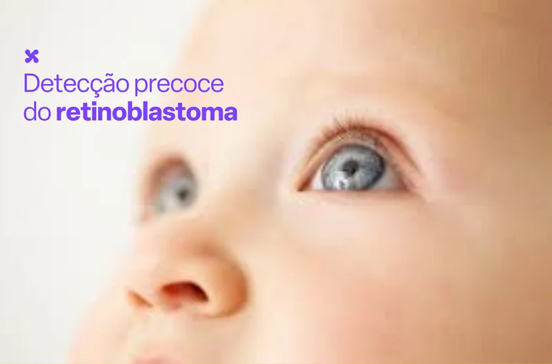 Detecção precoce do retinoblastoma